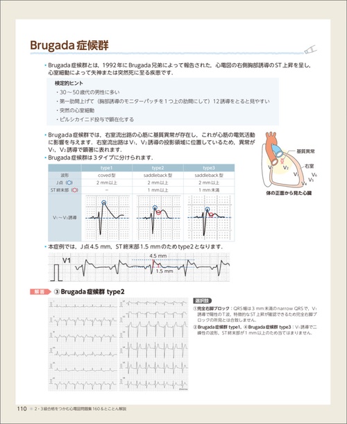 心電図マイスター 2冊まとめて 公式問題集および参考書籍 – 日本不整脈心電学会