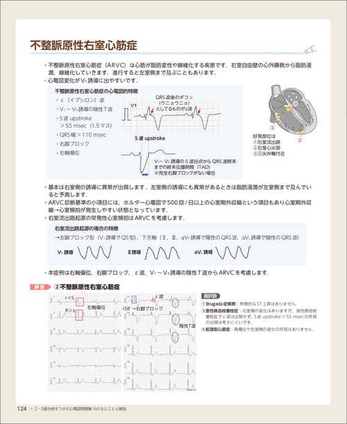 2・3級合格をつかむ心電図問題集160＆とことん解説 – 丸善ジュンク堂