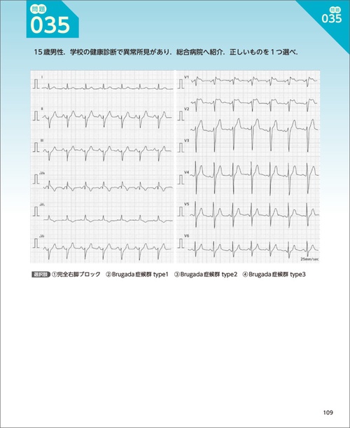2・3級合格をつかむ心電図問題集160＆とことん解説 – 丸善