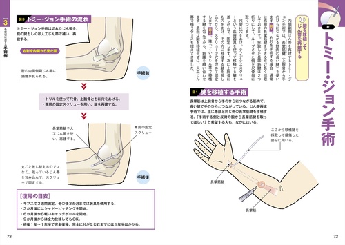 投球障害0へ！ ゼロポジションでつくる最強の肩と肘 – 丸善ジュンク堂