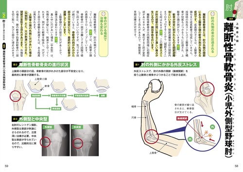 投球障害0へ！ ゼロポジションでつくる最強の肩と肘 – 丸善ジュンク堂