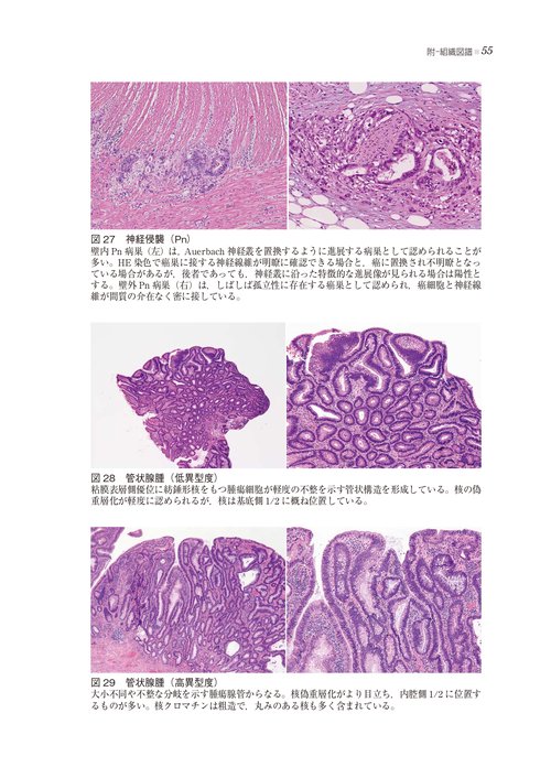 小腸癌取扱い規約 – 丸善ジュンク堂書店ネットストア