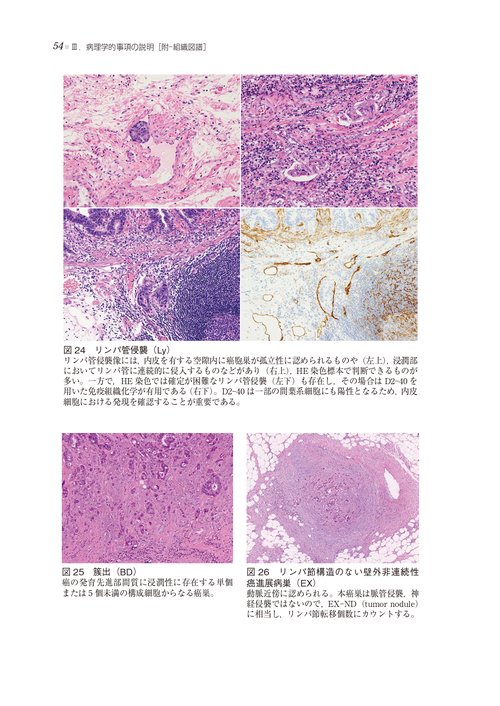 結腸・直腸癌の外科/金原出版/土屋周二（単行本） 結腸・直腸癌の外科/金原出版/土屋周二（単行本） Amazon.co.jp