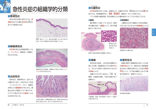イラスト病理学 イラスト 病理学 - 株式会社 東京教学社
