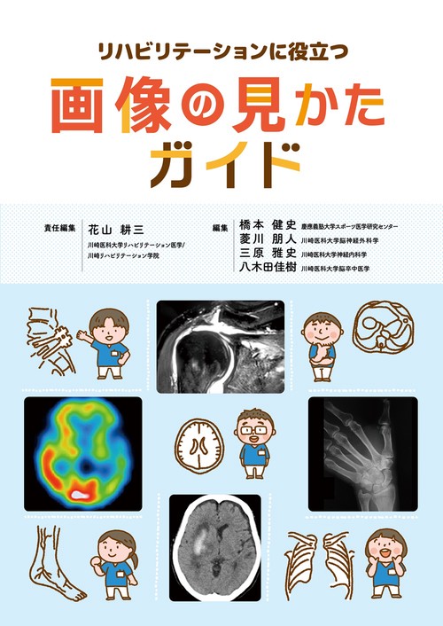 リハビリテーションに役立つ画像の見かたガイド – 丸善ジュンク堂書店
