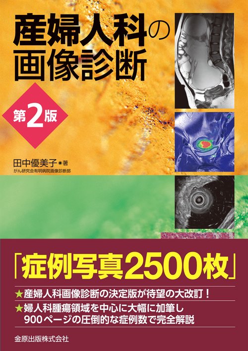 産婦人科の画像診断 第2版 – 丸善ジュンク堂書店ネットストア