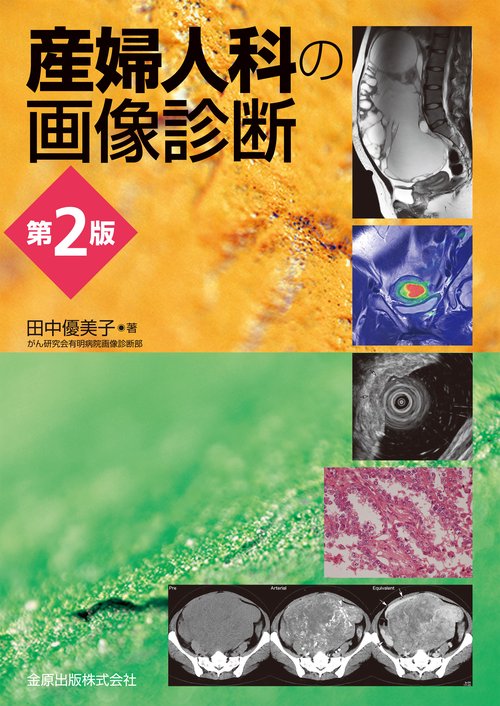 産婦人科の画像診断 第2版 – 丸善ジュンク堂書店ネットストア