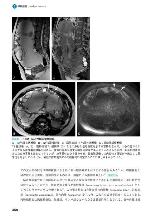 裁断済】産婦人科の画像診断 第2版 産婦人科の画像診断 第2版 | 田中