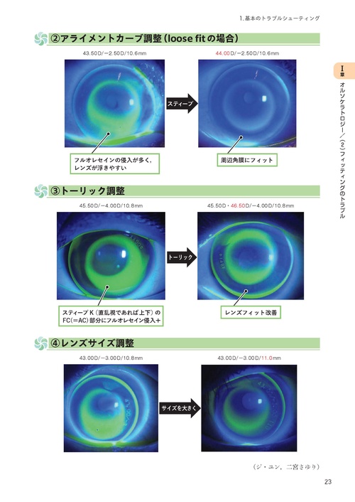 写真でわかる！オルソケラトロジーフィッティング 学童の近視抑制 お