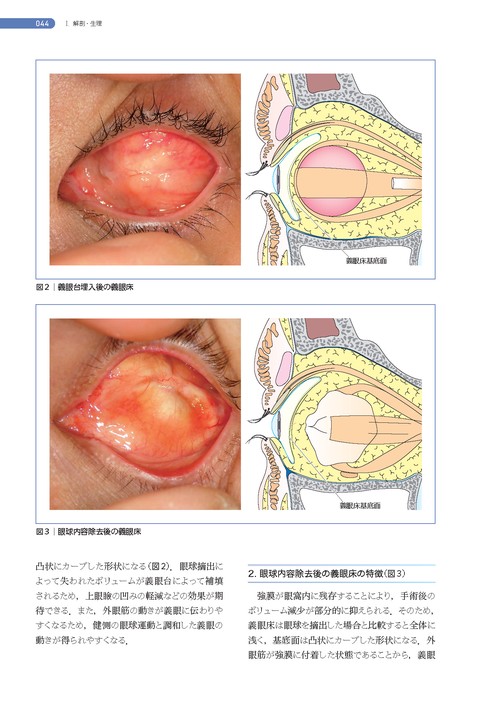 処置室でできる 低侵襲・眼瞼診療 切らない眼科医のアプローチ (新篇