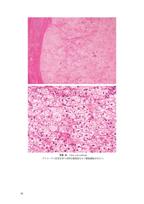 臨床・病理 原発性肝癌取扱い規約 第7版 – 丸善ジュンク堂書店ネットストア