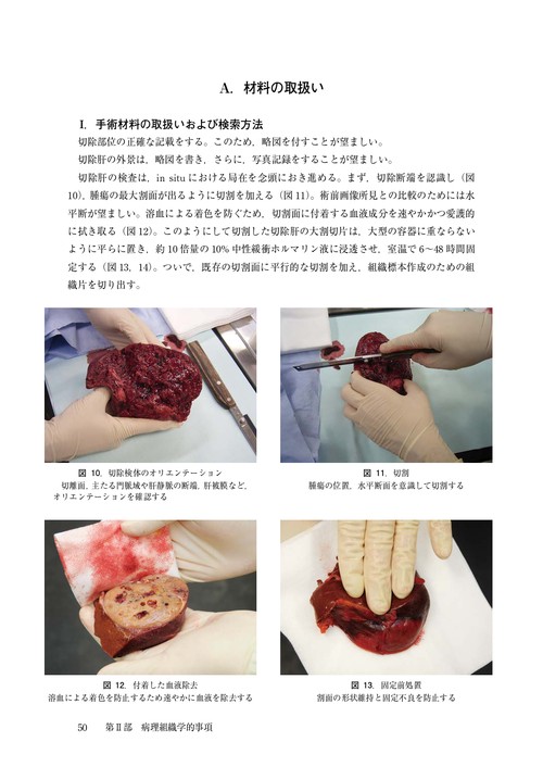 臨床・病理 原発性肝癌取扱い規約 第7版 – 丸善ジュンク堂書店ネットストア