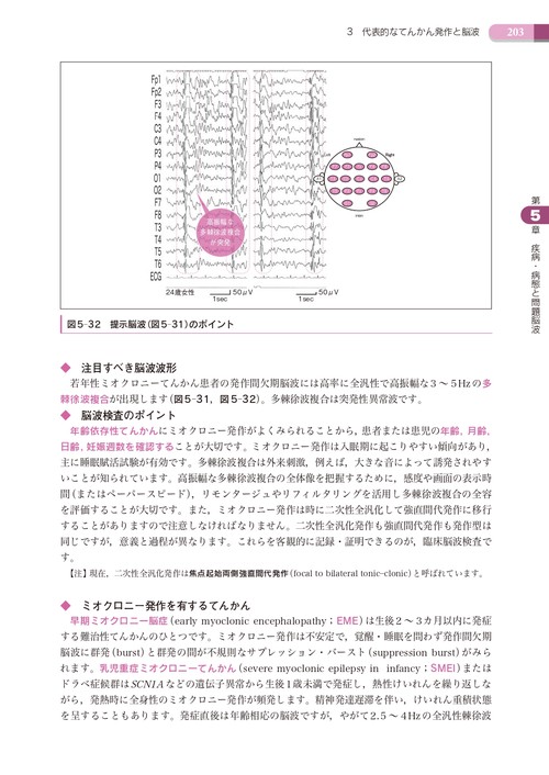 臨床脳波検査スキルアップ 第2版 補訂版 – 丸善ジュンク堂書店ネットストア