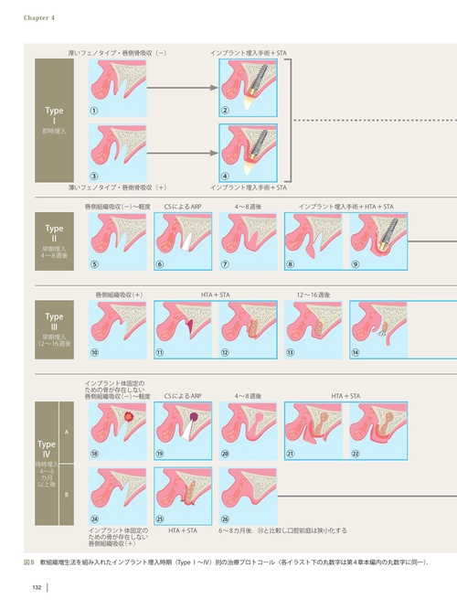 前歯部インプラントクリニカルガイド – 丸善ジュンク堂書店ネットストア