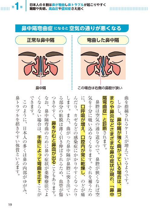 副鼻腔炎 ちくのう 花粉症・アレルギー性鼻炎・後鼻漏 鼻づまり・鼻水