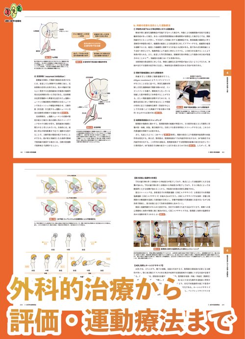 股関節拘縮の評価と運動療法 改訂版 – 丸善ジュンク堂書店ネットストア