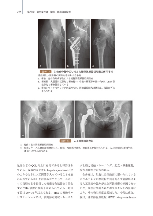 神中整形外科学 上巻 改訂第23版 神中整形外科学 上巻 | 岩本 幸英 |本 | 通販 | Amazon