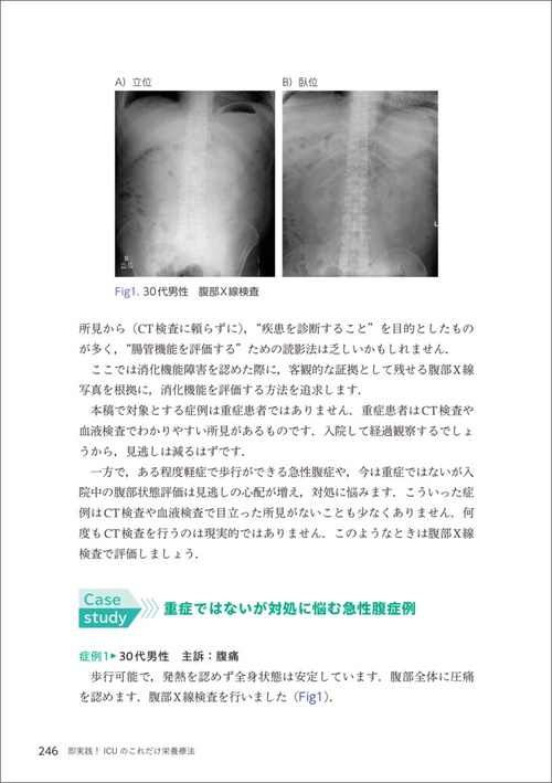 即実践！ICUのこれだけ栄養療法 – 丸善ジュンク堂書店ネットストア