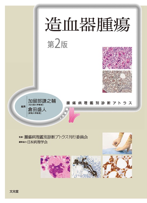腫瘍病理鑑別診断アトラス 造血器腫瘍 第2版 – 丸善ジュンク堂書店