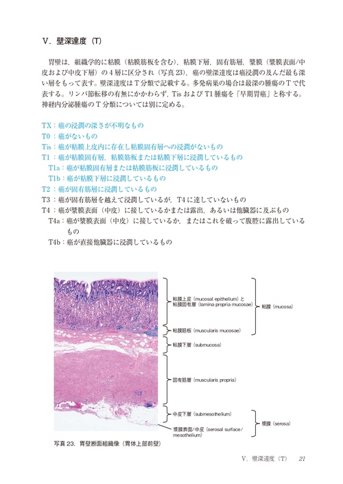 胃癌取扱い規約 第16版 – 丸善ジュンク堂書店ネットストア