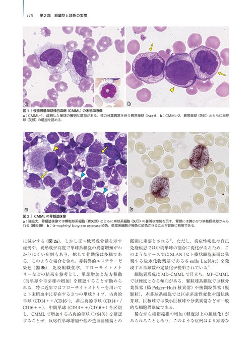 腫瘍病理鑑別診断アトラス 造血器腫瘍 第2版 – 丸善ジュンク堂書店