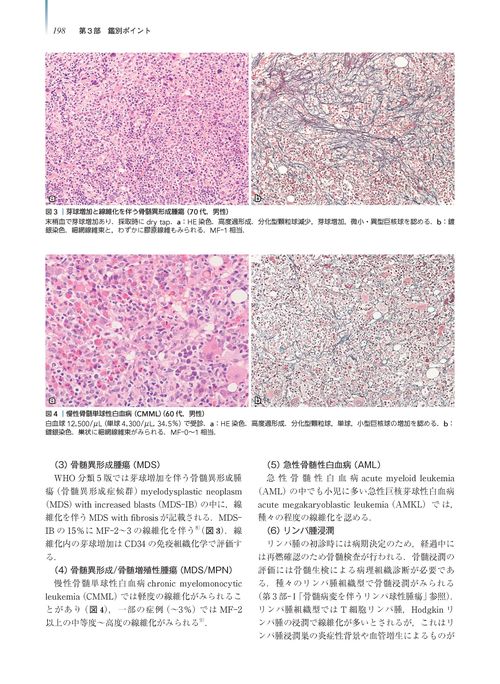 腫瘍病理鑑別診断アトラス 造血器腫瘍 第2版 – 丸善ジュンク堂書店