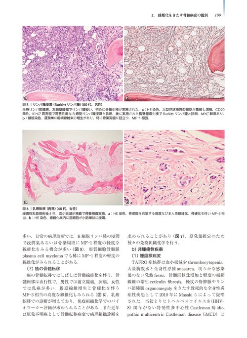 腫瘍病理鑑別診断アトラス 造血器腫瘍 第2版 – 丸善ジュンク堂書店