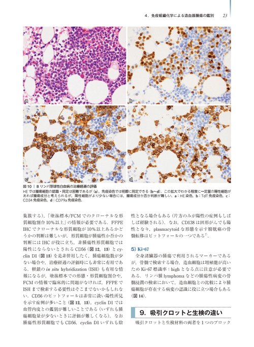 腫瘍病理鑑別診断アトラス 造血器腫瘍 第2版 – 丸善ジュンク堂書店