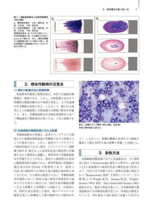 腫瘍病理鑑別診断アトラス 造血器腫瘍 第2版 裁断済み 造血器腫瘍 第2版(腫瘍病理鑑別診断アトラス) | 加留部謙之輔, 倉田盛