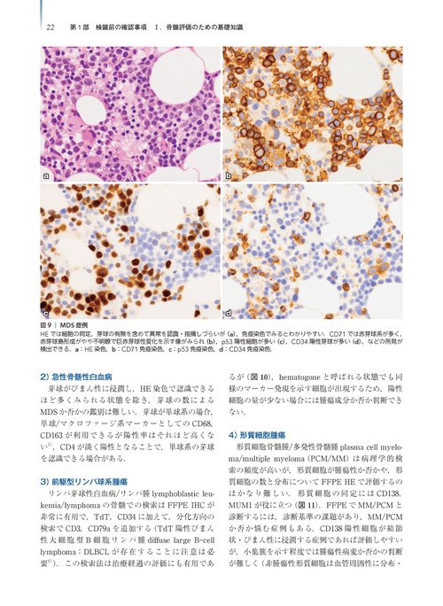 腫瘍病理鑑別診断アトラス 造血器腫瘍 第2版 – 丸善ジュンク堂書店