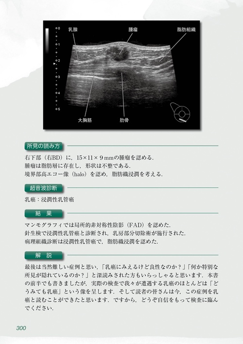 乳房超音波トレーニングブック 2 – 丸善ジュンク堂書店ネットストア