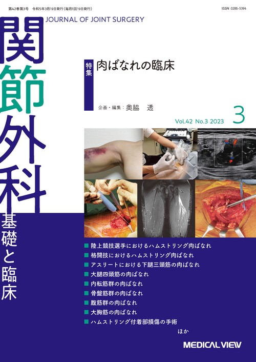 関節外科基礎と臨床 2023年 03月号 [雑誌]