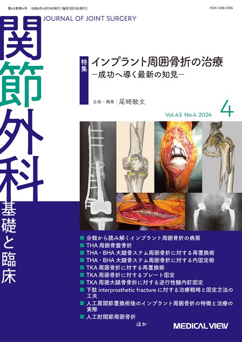 関節外科基礎と臨床 2024年 04月号 [雑誌]