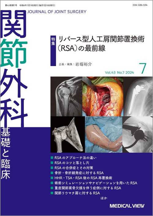 関節外科基礎と臨床 2024年 07月号 [雑誌]