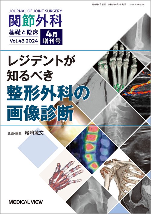 関節外科基礎と臨床増レジデントが知るべ 2024年 04月 別冊・臨時増刊 [雑誌]