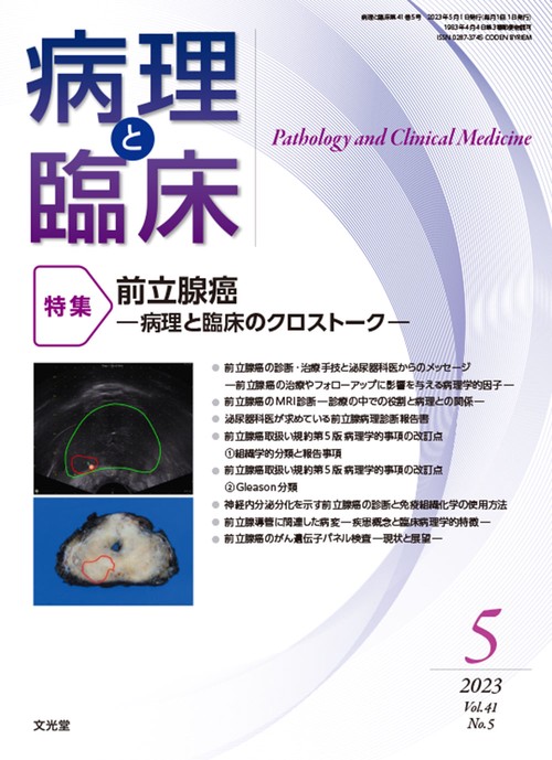 病理と臨床 2023年 05月号 [雑誌]