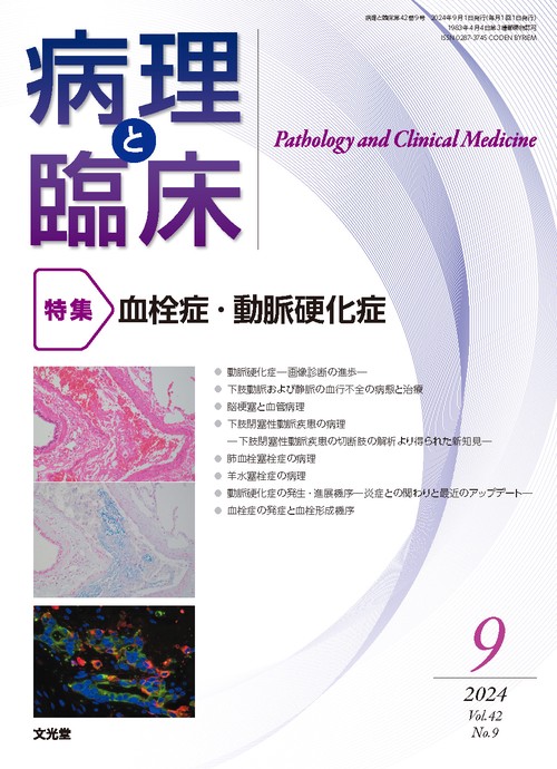 病理と臨床　2024年9月号（42巻9号）：【特集】血栓症・動脈硬化症 (2024年09月号) [雑誌]