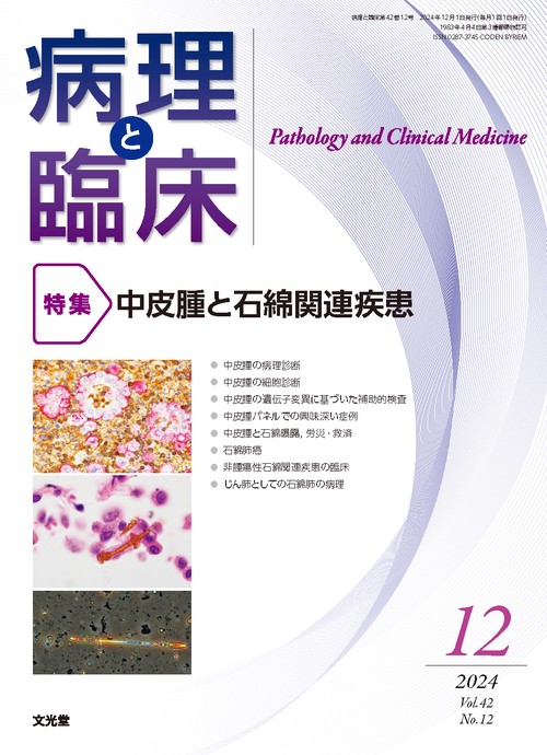 病理と臨床　2024年12月号（42巻12号）：【特集】中皮腫と石綿関連疾患 (2024年12月号) [雑誌]