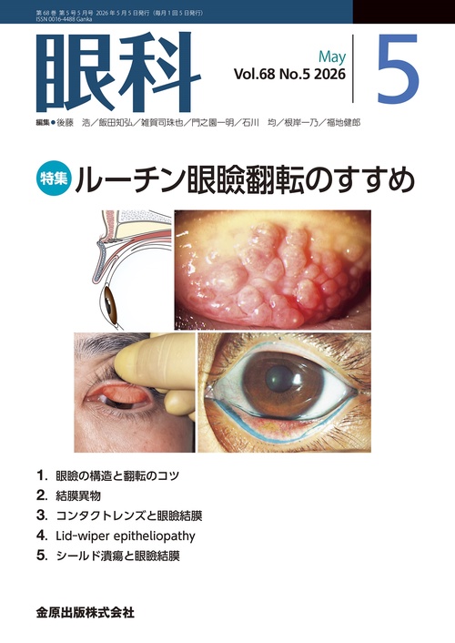 眼科　2026年5月号 (2026年05月号) [雑誌]