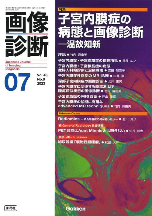 画像診断２０２３年７月号　Ｖｏｌ．４３　Ｎｏ．８