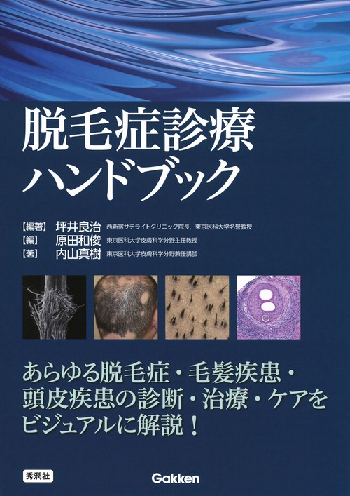 脱毛症診療ハンドブック