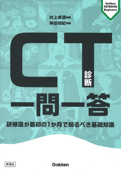 ＣＴ診断一問一答