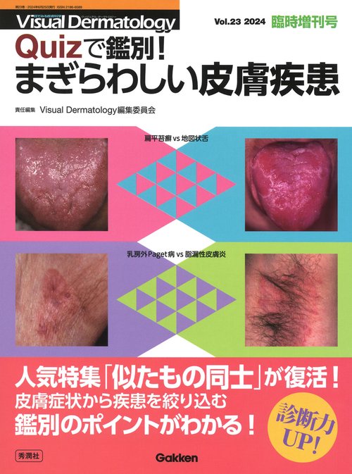 Ｖｉｓｕａｌ　Ｄｅｒｍａｔｏｌｏｇｙ２０２４年臨時増刊号