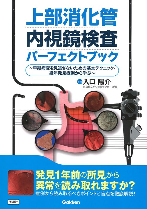 上部消化管内視鏡検査パーフェクトブック