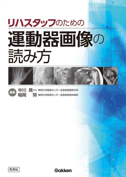リハスタッフのための運動器画像の読み方