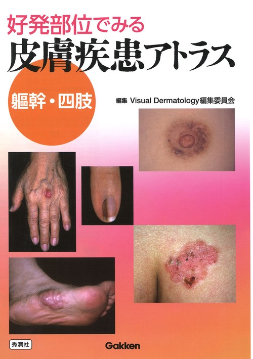 好発部位でみる皮膚疾患アトラス　躯幹・四肢