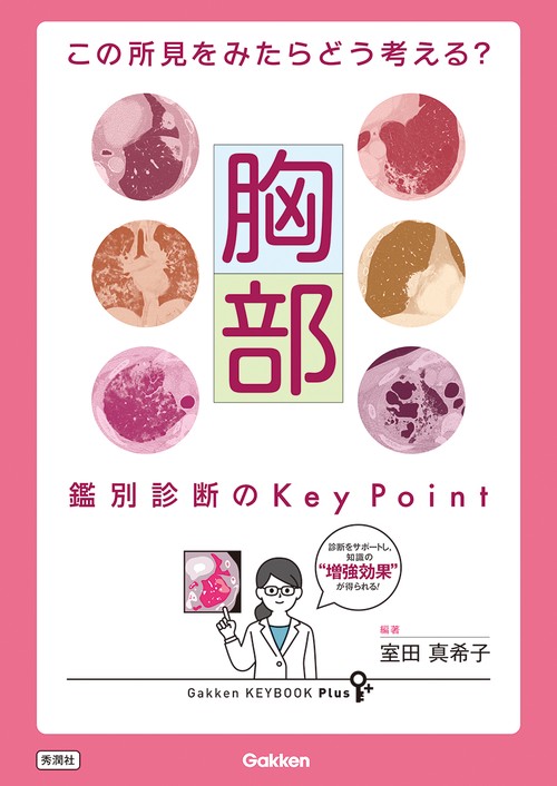 この所見をみたらどう考える？　胸部　鑑別診断のＫｅｙ　Ｐｏｉｎｔ