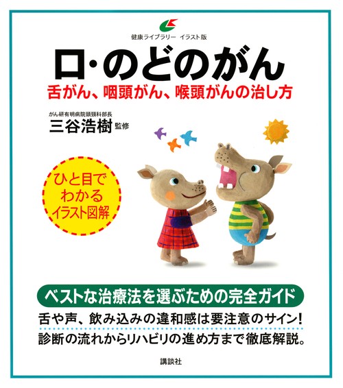 口・のどのがん　舌がん、咽頭がん、喉頭がんの治し方