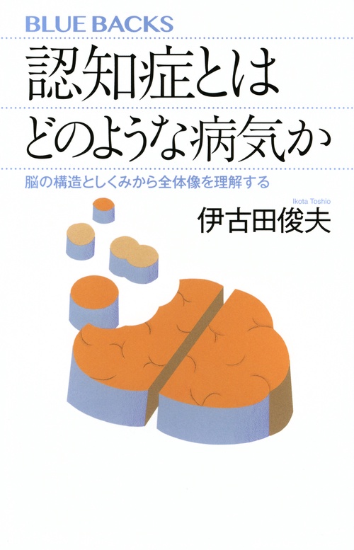 認知症とはどのような病気か　脳の構造としくみから全体像を理解する