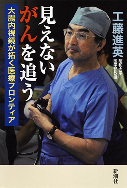 見えないがんを追う 大腸内視鏡が拓く医療フロンティア